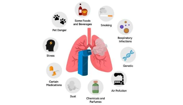 Illustration of lungs surrounded by asthma triggers: pet danger, smoking, stress, certain medications, foods, infections, air pollution, dust, genetics, and chemicals.