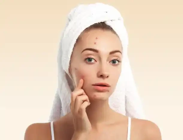 Woman with towel on head touching acne on cheek.