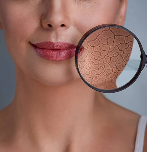 Close-up of woman’s face showing dry skin under magnifying glass